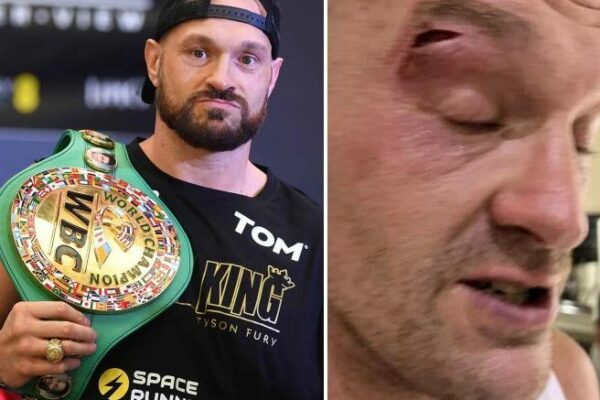 Injury to the eye forces Fury to pull out of Usyk fight for the heavyweight title- Corriere.it